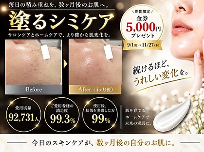 テセラ(Tethere)の写真