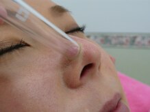 クリニカルエステクリア 梅田店/フェィシャル