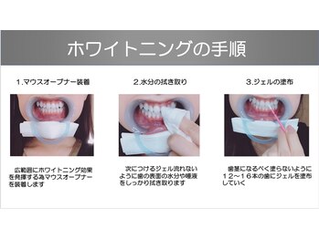 ラブホワイトニング 恵比寿店(LOVEホワイトニング)/セルフホワイトニングのやり方