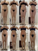 プラチナアース 守谷店(Platinum earth)/痩身ビフォーアフター