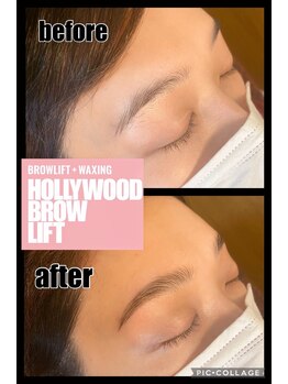 トータルビューティーサロン アリス(ALICE)/HBL ビフォーアフター