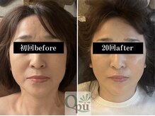 キュープ 富士店(Qpu)の雰囲気（寝落ちできるほど気持ちのいい唯一無二の施術です！小顔/富士市）