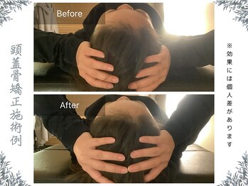 ボディ リセット アンド デザイン(Body Reset & Design)/【施術例】ビフォーアフター