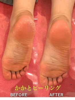 ビューティースパ/足裏かかとピーリング