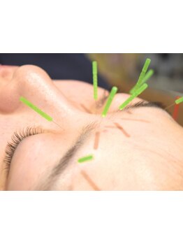 眼精疲労を解消したい