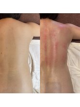 ビューティーサロンエイト(Beauty Salon8)/全身3時間コース