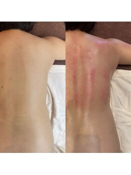 ビューティーサロンエイト(Beauty Salon8)/全身3時間コース