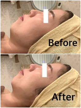 スペチアーレ 夙川/驚きのリフトアップ