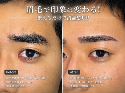 リンク(LINK)の写真