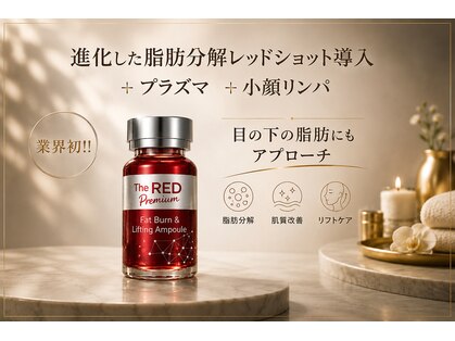 アルビス(ARVISS)の写真
