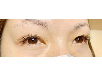 アンドリタ/フラットラッシュ140本