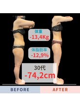 エステティック エイチアンドビー 大和店(H&B)/ビフォーアフター