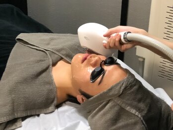 ルース(LUZ)/メンズ顔脱毛/川口市/ヒゲ/顔