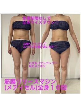 セルビューティー(Cell Beauty)/20代、筋膜リリース全身10回