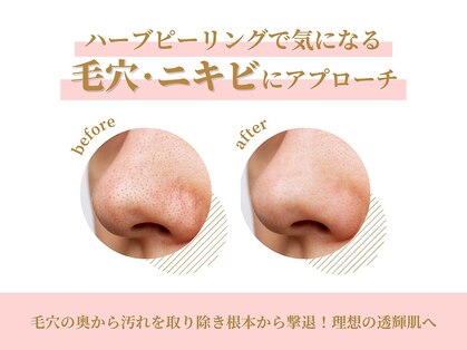 パーフェクトフェイスビューティー 難波店(PERFECT FACE BEAUTY)の写真