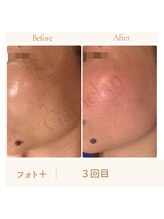 ガムラン(Gamelan)/フォト＋　（3回目）