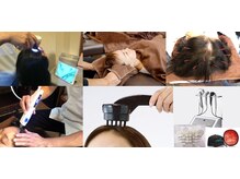 レメディ/グロスファクター育毛促進鍼