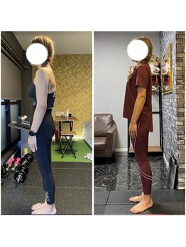 レガリス(REGALIS)/before/after ボディメイク