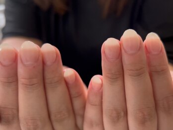シュアム(shuam)の写真/爪のコンプレックスを一緒に克服！実体験から生まれた爪悩みに寄り添うサロン＊”見せたくなる爪”を叶える