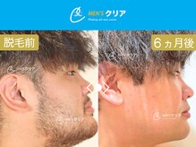 メンズクリア パティオ本八幡店