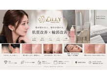 リリー(LILLY)