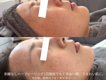 サロンサイ(salonsai)の写真