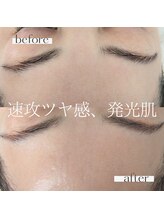 ケアプラス/ハリ、ツヤUPで発光肌