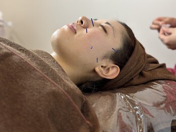 カラダロム (RE:KARADA ROM)/人気の美容鍼＆小顔矯正。