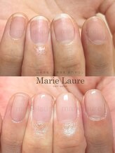 マリーロール 淀屋橋本店(Marie Laure)/自爪育成/深爪矯正/ネイルケア