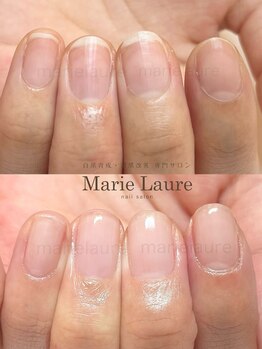マリーロール 淀屋橋本店(Marie Laure)/自爪育成/深爪矯正/ネイルケア