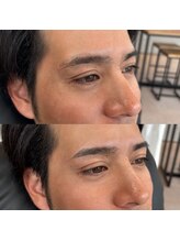 アルデオンワン セカンド(ARDEON.1 second)/【メンズ眉毛】Before/after