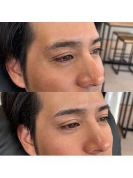 アルデオンワン セカンド(ARDEON.1 second)/【メンズ眉毛】Before/after