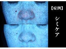 The水光美肌専科/毛穴も解決