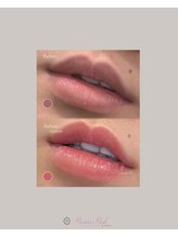 凰湖/【メラニンケア】ローマピンク