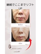 フェイシャルサロン セレスタイト/2カ月後の継続効果