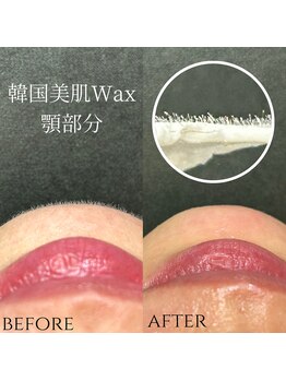 エルミュ(Elmu)/韓国美肌Wax