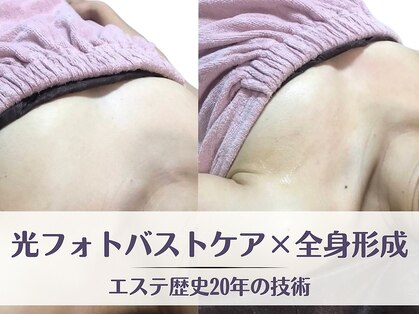 フルーブラン(Frubran)の写真