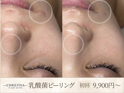 キヌ(KINU)の写真