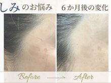 サロン ド コスメ ベル フルール(Salon de Cosme Belle Fleur)