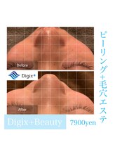 デジックスプラス(Digix+)/【エステ】