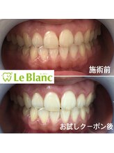 ルブラン 奈良店(Le Blanc)/歯で印象が決まる！？