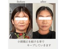 施術前はしっかりとカウンセリングしお客様の悩みを改善します