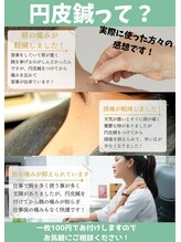 こうのみや接骨院 鍼灸院/円皮鍼ってなに？？