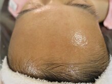 ビューティーメイクさくら/ポツポツ肌改善