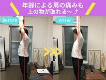 京都中丸整体カイロプラクティック/肩の痛み