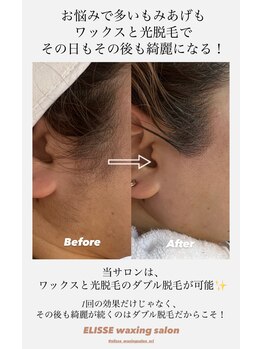 エリス(ELISSE)/もみあげもワックスで綺麗に整う