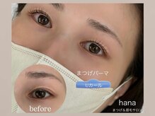 ハナ 佐賀店(hana)/まつげパーマ/上下/パリジェンヌ