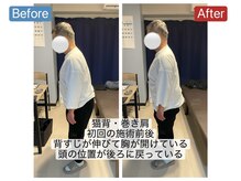 アンティオール 桜木町店/Before→After