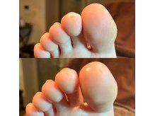 フットケアのスペシャリストが足元のトラブルを解消します！