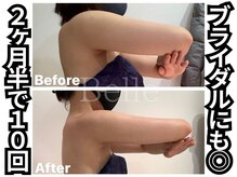 ベル 南船場店(Belle)の雰囲気(ブライダルにも◎頑固な二の腕の脂肪も撃退☆痩身全身~部分も◎)